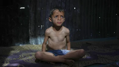 على حافة الموت… الجوع يفتك بأطفال غزة وسط تفاقم سوء التغذية