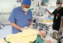 بدء عملية فصل التوأم الطفيلي عن المصري محمد عبد الرحمن جمعة