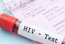 نهج جديد للقاحات المضادة لفيروس نقص المناعة البشرية يظهر نتائج مبكرة واعدة
