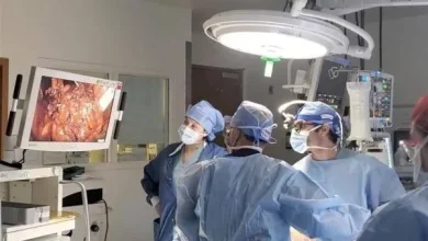 نجاح عملية زرع مثانة بشرية في الولايات المتحدة في سابقة عالمية