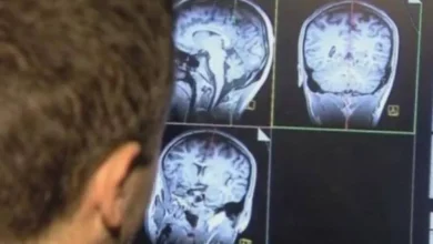 علاج مناعي يحدث اختراقاً جديداً في علاج سرطان الرقبة والرأس